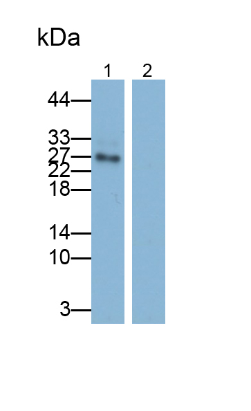 Polyclonal Antibody to Tumor Necrosis Factor Alpha (TNFa)