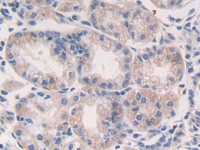 Polyclonal Antibody to Tumor Necrosis Factor Beta (TNFb)