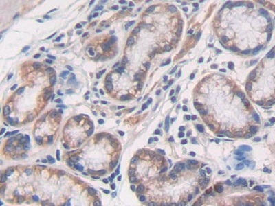 Polyclonal Antibody to Tumor Necrosis Factor Beta (TNFb)