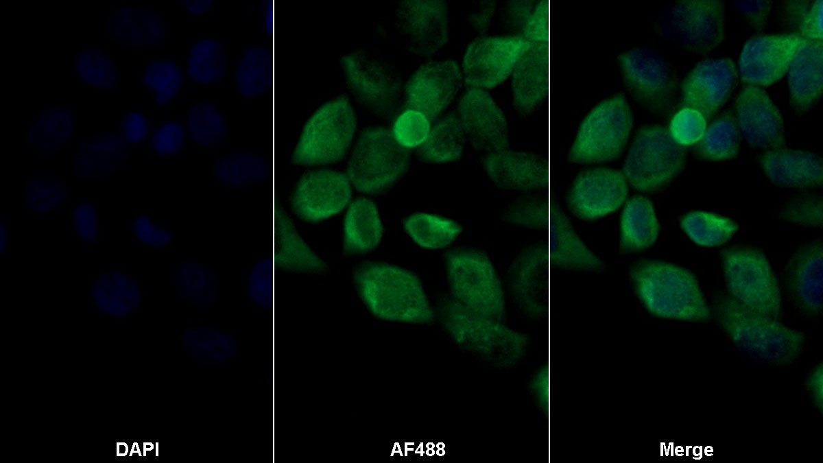 Polyclonal Antibody to Tumor Necrosis Factor Related Apoptosis Inducing Ligand (TRAIL)