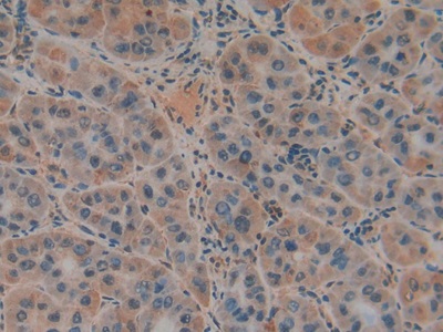 Polyclonal Antibody to Plasminogen Activator, Urokinase Receptor (uPAR)