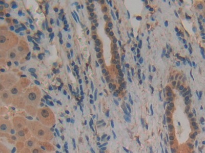 Polyclonal Antibody to Plasminogen Activator, Urokinase Receptor (uPAR)