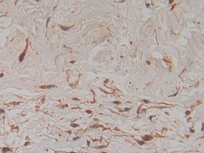 Polyclonal Antibody to Plasminogen Activator, Urokinase Receptor (uPAR)