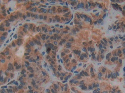Polyclonal Antibody to Plasminogen Activator, Urokinase Receptor (uPAR)