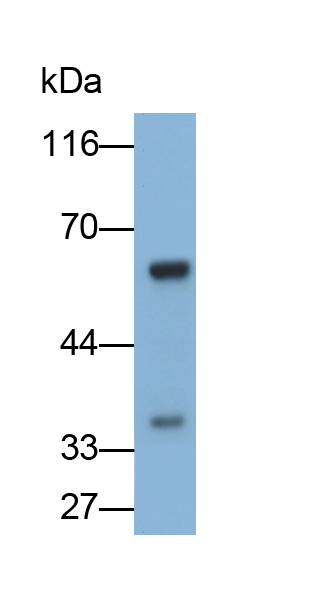 Polyclonal Antibody to Vascular Endothelial Growth Factor A (VEGFA)
