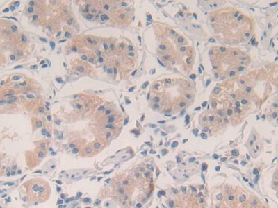 Polyclonal Antibody to Vascular Endothelial Growth Factor A (VEGFA)