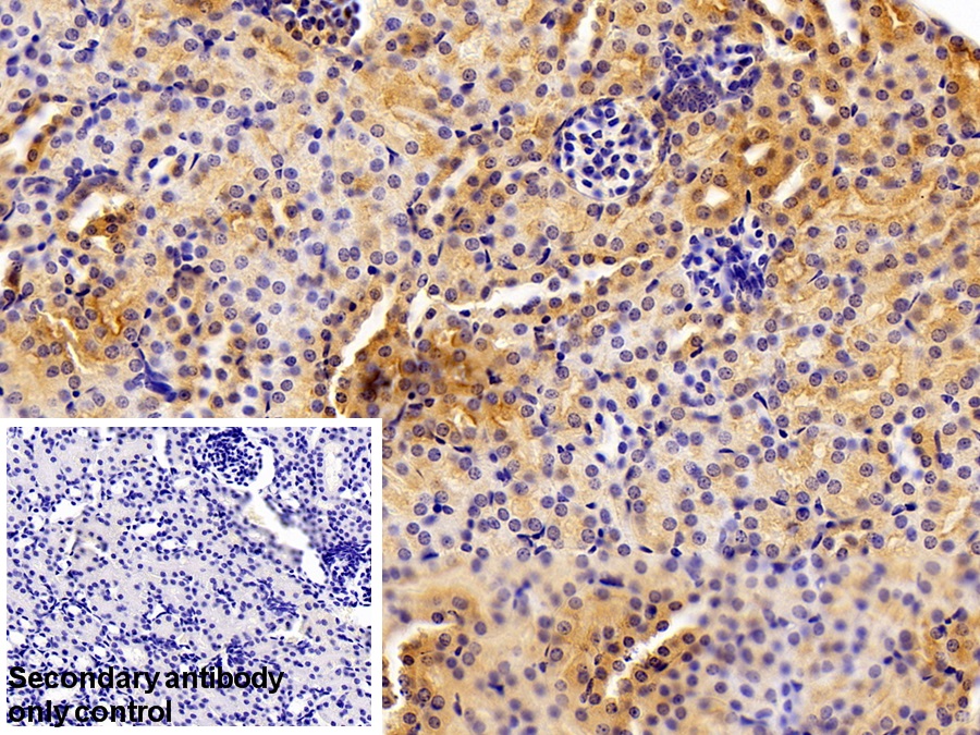 Polyclonal Antibody to Vascular Endothelial Growth Factor A (VEGFA)