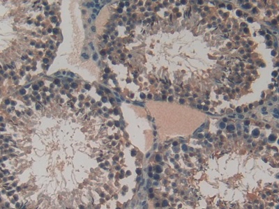 Polyclonal Antibody to Vascular Endothelial Growth Factor C (VEGFC)