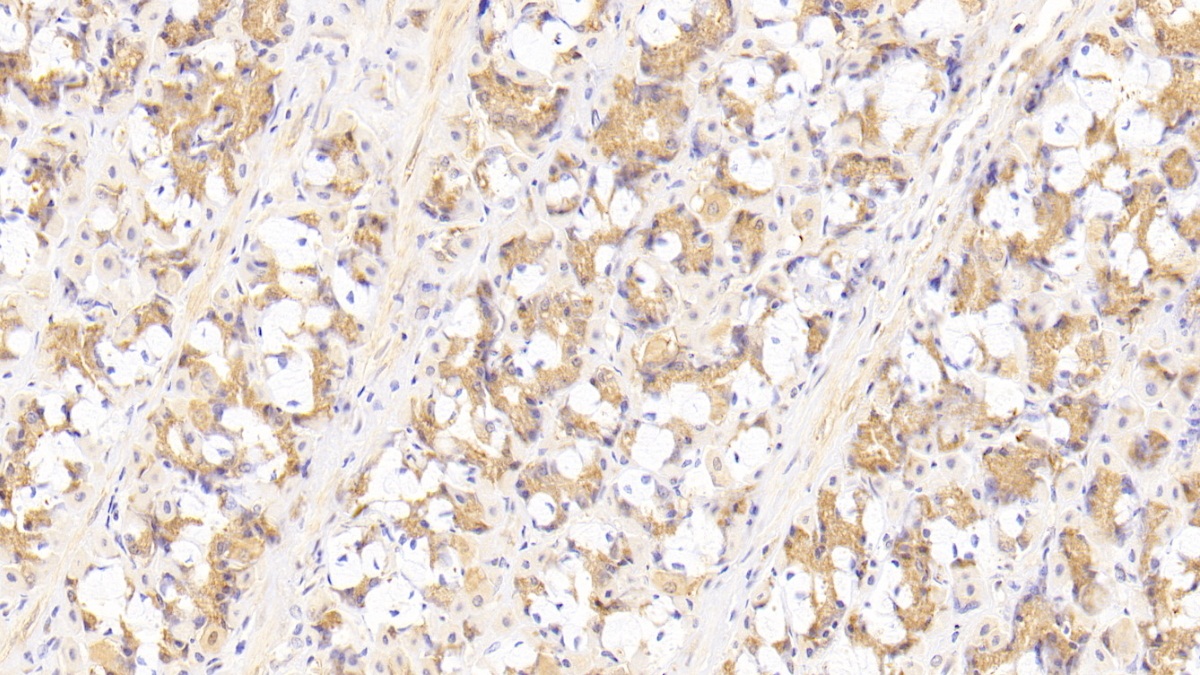 Polyclonal Antibody to Vascular Endothelial Growth Factor D (VEGFD)