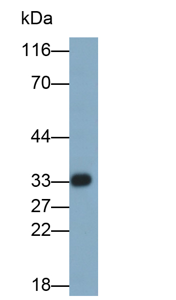 Polyclonal Antibody to Prostate Specific Antigen (PSA)
