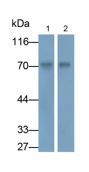 Polyclonal Antibody to Alpha-Fetoprotein (AFP)