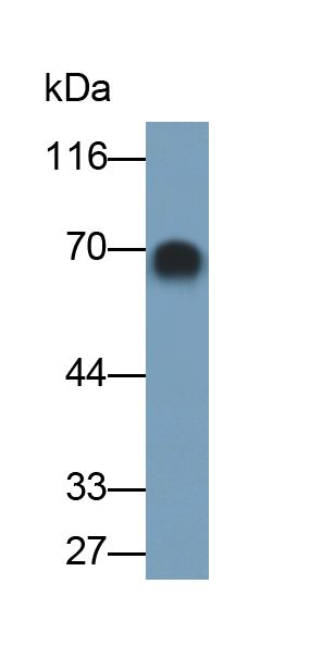 Polyclonal Antibody to Alpha-Fetoprotein (AFP)