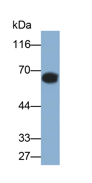 Polyclonal Antibody to Alpha-Fetoprotein (AFP)