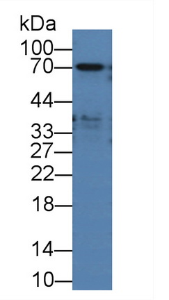 Polyclonal Antibody to Alpha-Fetoprotein (AFP)