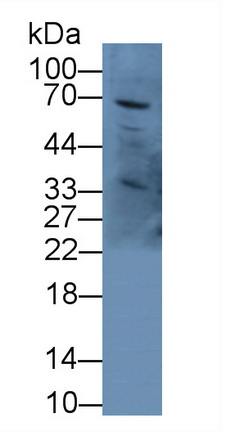 Polyclonal Antibody to Alpha-Fetoprotein (AFP)