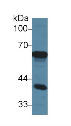 Polyclonal Antibody to Alpha-Fetoprotein (AFP)