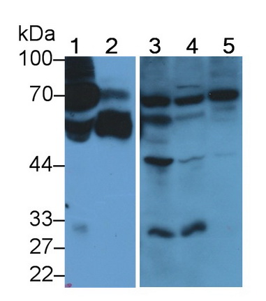 Polyclonal Antibody to Alpha 2-Antiplasmin (a2PI)