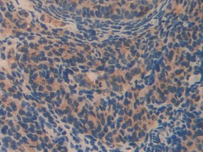 Polyclonal Antibody to Olfactomedin 4 (OLFM4)