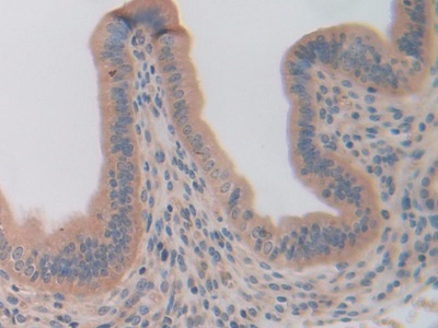 Polyclonal Antibody to Olfactomedin 4 (OLFM4)