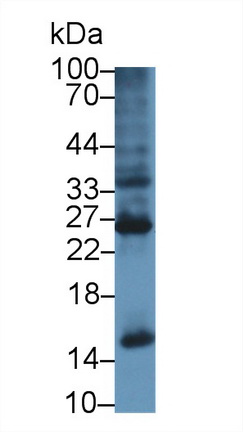 Polyclonal Antibody to Ubiquitin (Ub)