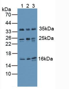 Polyclonal Antibody to Ubiquitin (Ub)