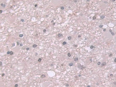 Polyclonal Antibody to Ubiquitin (Ub)