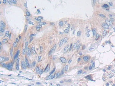 Polyclonal Antibody to Prostatic Acid Phosphatase (PAP)