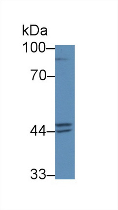 Polyclonal Antibody to Prostatic Acid Phosphatase (PAP)