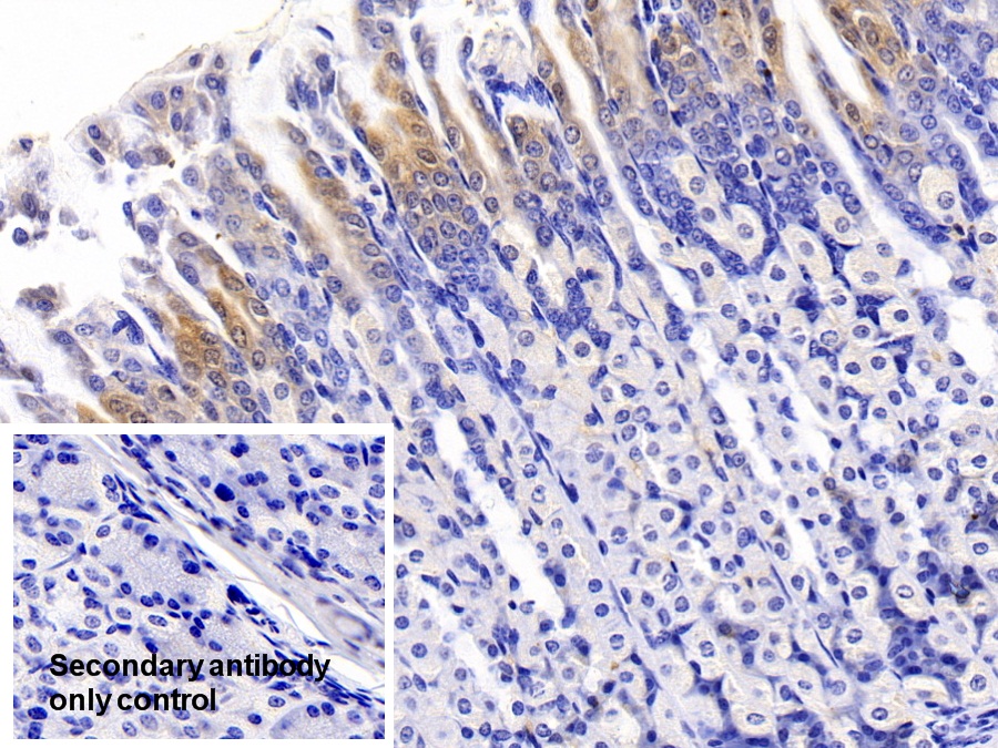 Polyclonal Antibody to Meprin A Alpha (MEP1a)