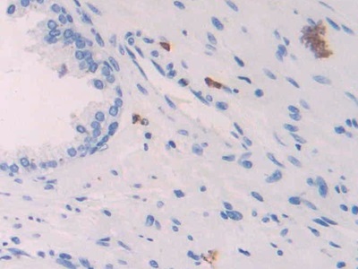 Polyclonal Antibody to Platelet Factor 4 (PF4)