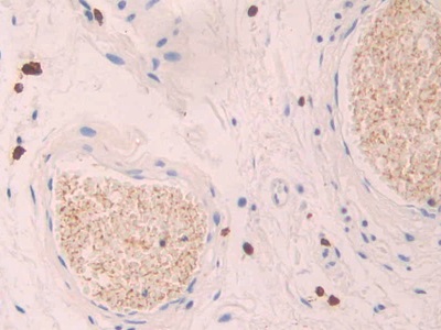 Polyclonal Antibody to Platelet Factor 4 (PF4)