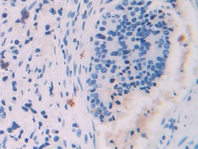 Polyclonal Antibody to Platelet Factor 4 (PF4)