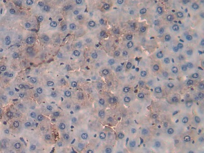 Polyclonal Antibody to Platelet Factor 4 (PF4)