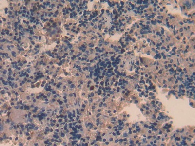 Polyclonal Antibody to Platelet Factor 4 (PF4)