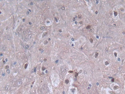 Polyclonal Antibody to Platelet Factor 4 (PF4)