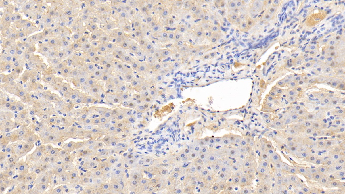 Polyclonal Antibody to Alpha-2-Heremans Schmid Glycoprotein (AHSG)