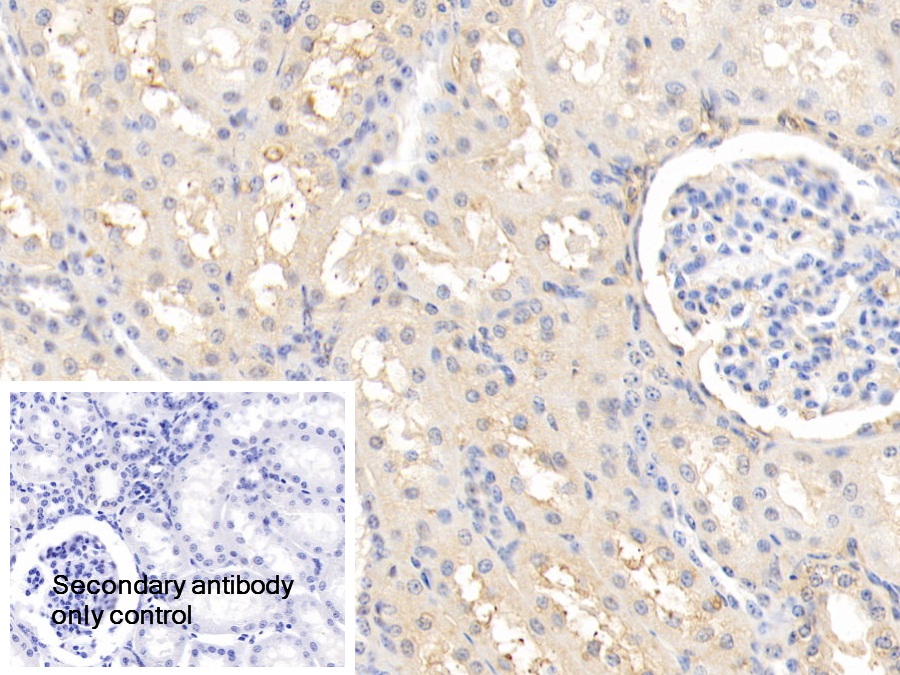 Polyclonal Antibody to Alpha-2-Heremans Schmid Glycoprotein (AHSG)