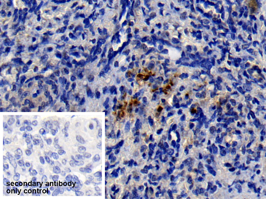 Polyclonal Antibody to Neutrophil Elastase (NE)