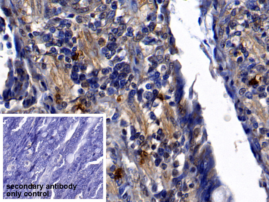 Polyclonal Antibody to Neutrophil Elastase (NE)