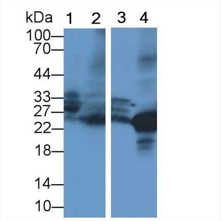 Polyclonal Antibody to Neutrophil Elastase (NE)