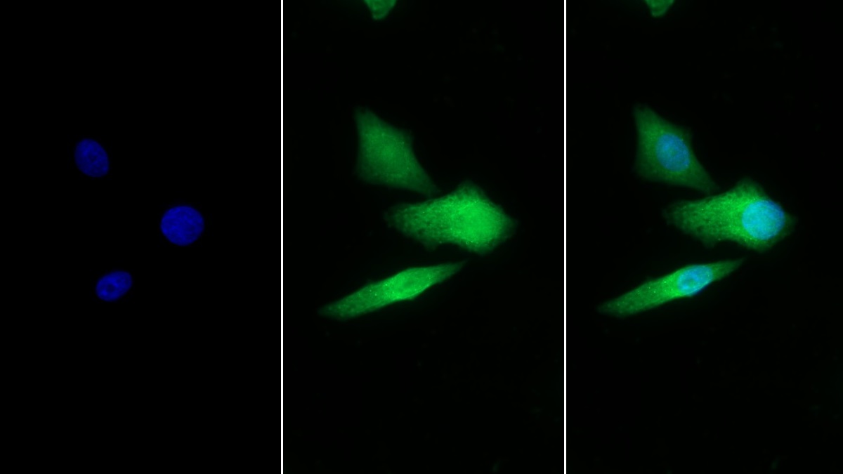 Polyclonal Antibody to Galactosidase Alpha (GLa)