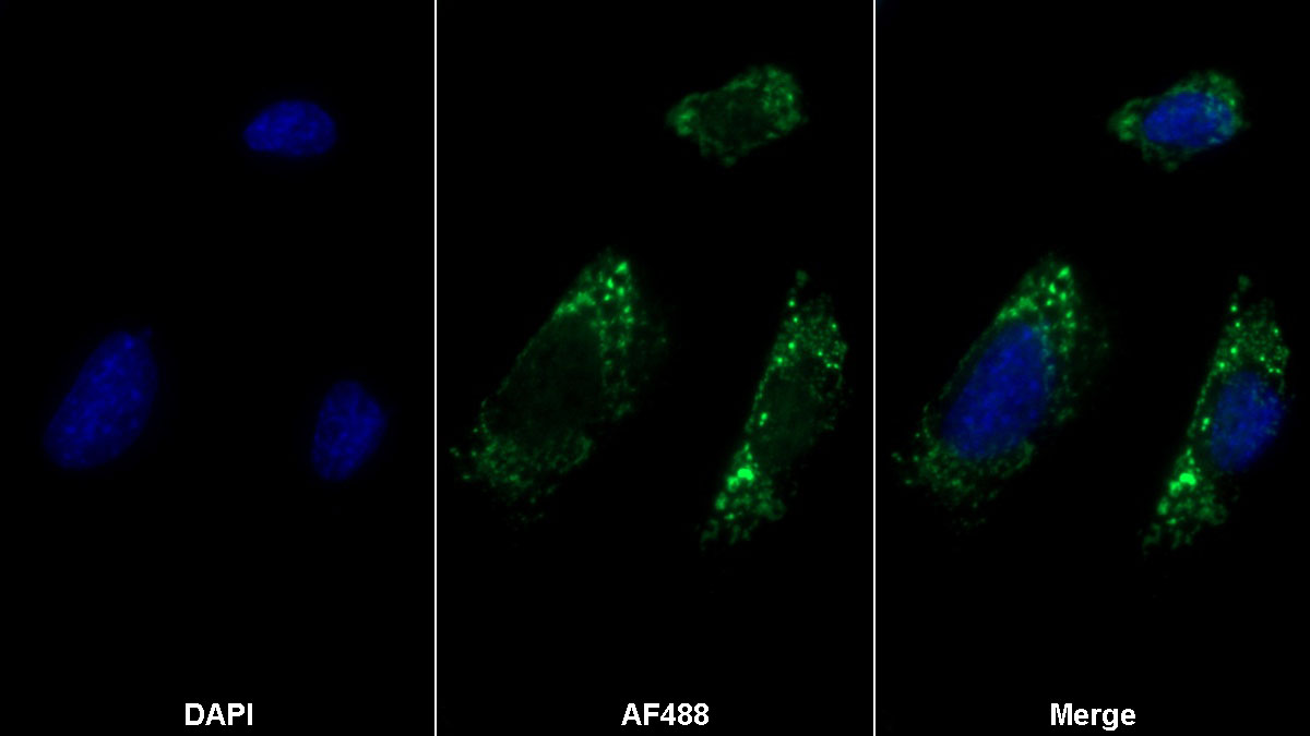 Polyclonal Antibody to Laminin Beta 1 (LAMb1)