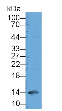 Polyclonal Antibody to Glycated Hemoglobin A1c (HbA1c)