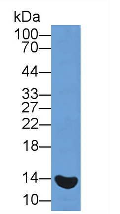 Polyclonal Antibody to Glycated Hemoglobin A1c (HbA1c)