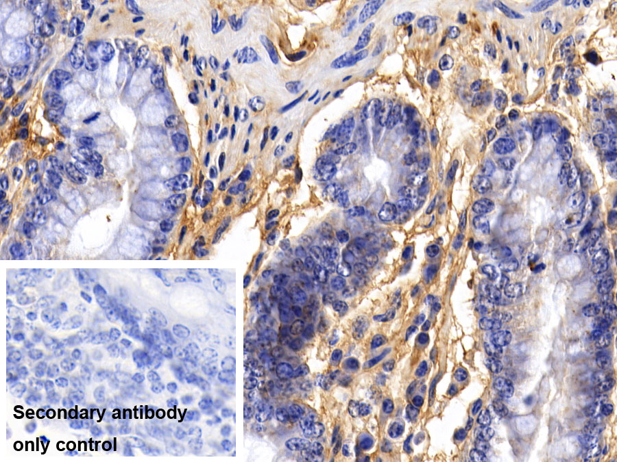 Polyclonal Antibody to Fibrinogen (FG)