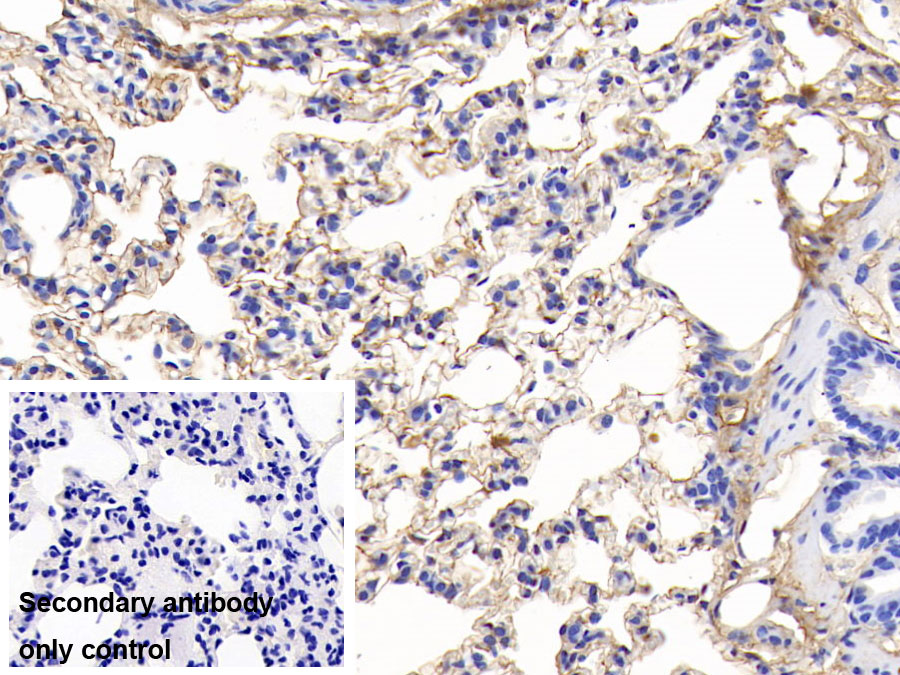 Polyclonal Antibody to Fibrinogen (FG)