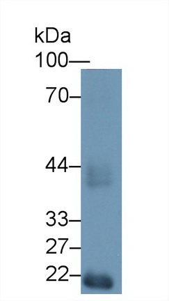 Polyclonal Antibody to Hexosaminidase A Alpha (HEXa)