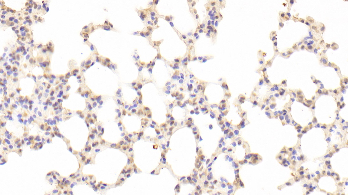 Polyclonal Antibody to Growth Arrest Specific Protein 6 (GAS6)