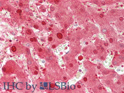 Polyclonal Antibody to Alanine Aminotransferase (ALT)