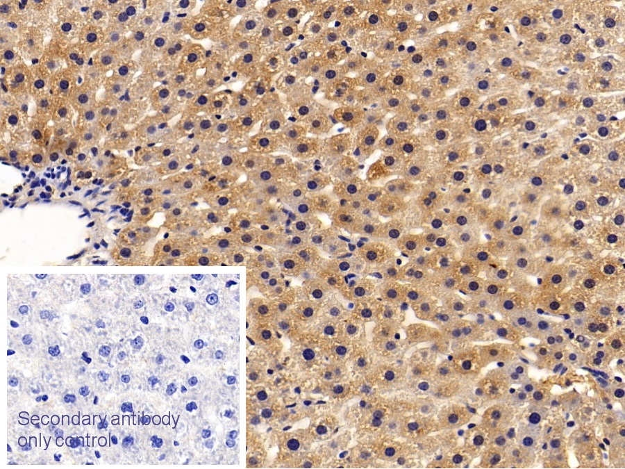 Polyclonal Antibody to Alanine Aminotransferase (ALT)